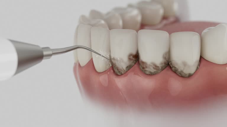Reliable Tooth Extraction contractor in Fannin County County, TX by Dentist Open Now